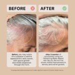 ACTIIV Thickening Hair Serum - Water Based | Supports the Appearance of Thicker, Fuller-Looking Hair, Lightweight Water-Based Formula, Non-Greasy, All Hair Types, 1.8 oz - Image 7