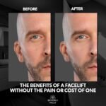 Beverly Hills Mens Instant Facelift and Eye Serum Treatment for Dark Circles, Puffy Eyes, and Wrinkles - Image 4