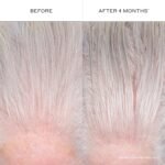 ZENAGEN Densifying Hair Serum for Fine + Thinning Hair | Boosts Hair Density, Strengthens & Nourishes Hair Follicles, Non-Greasy Water-Based Formula, Plant-Based, Vegan, All Hair Types - Image 8