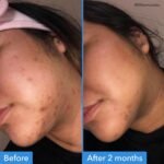 Good Molecules Discoloration Correcting Serum - Serum to Target Dark Spots and Discoloration - Skin Care for Face, 1 fl oz - Image 3