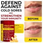 Cold Sore Treatment for Lip & Skin Support with L-Lysine, Zinc, Vitamin C & Probiotics | Vegan Immunity Booster That Helps Prevent Outbreaks & Promotes Faster Healing | 60 Berry Flavored Gummies - Image 8