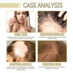 Natural Hair Growth Oil for Dry, Damaged & Thin Hair, Nourishing Unisex Formula (3 * 60ml) - Image 5