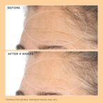 Perricone MD Neuropeptide Deep Crease Serum, 1 fl oz. - Image 7