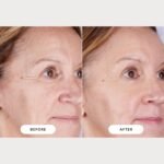 CurrentBody Skin LED Light Therapy Mask: Series 2 - Image 4