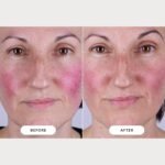 CurrentBody Skin LED Light Therapy Mask: Series 2 - Image 5
