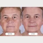 CurrentBody Skin LED Light Therapy Mask: Series 2 - Image 3