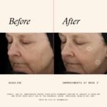 SkinMedica TNS Advanced+ Face Serum - Multi Peptide Serum to Help Improve the Appearance of Wrinkles, Fine Lines, Skin Tone & Texture (1 oz) - Image 4