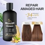 Minoxidil Shampoo & Conditioner Set for Hair Growth – Biotin, Ginseng & Ginger – Supports Thicker, Fuller Hair – Scalp Care Formula – For Men & Women – 600ml Duo - Image 8