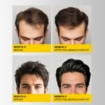 Hair Growth Shampoo and Conditioner Set: Sulfate Free Hair Growth Root Activator Thickening Shampoo for Hair Loss and Thinning Hair - Hair Loss RegrowthTreatments for Women Men - Image 3