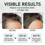 Batana Oil for Hair Growth with Rosemary, Biotin & Castor Oil, Hair Growth Oil for Thinning Hair & Hair Loss, Deep Nourishing Scalp Repair, Repair Damaged Hair & Split Ends, For Women & Men, 4.2 oz - Image 4