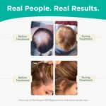 Shapiro MD Hair Growth Experts Hair Loss Shampoo and Conditioner, DHT Fighting Vegan Formula for Thinning Hair Developed by Dermatologists, Experience Healthier, Fuller & Thicker Looking Hair - Image 5