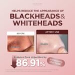 SKIN1004 [Hudson's Pick] Poremizing Quick Clay Stick Mask, Facial Clay Mask for Pores, Centella Clay Stick for Pore Minimizing, Pink Pore Mud Mask for Sebum Balance, Korean Skin Care, 0.95 oz / 27g - Image 4