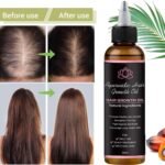 Lifewitqueenp Queenp Ayurvedic Hair Growth Oil, 1pcs | Hair Care Growth Oil, Lightweight, All Hair Types - Image 3