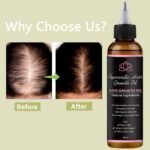Lifewitqueenp Queenp Ayurvedic Hair Growth Oil, 1pcs | Hair Care Growth Oil, Lightweight, All Hair Types - Image 2