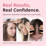 ForChics Hair Growth Serum for Women- Results in 4 Weeks- Hormone Free Hair Regrowth Treatment - For Thinning Hair Loss - Fast Absorbing Non-Greasy Scalp Spray 50ml - Image 3
