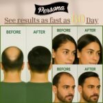 Hair Growth Serum – Advanced Biotin with Caffeine, Peptides, Botanical Extract for Thicker, Fuller, Longer Hair, Reduces Hair Thinning, Hair Regrowth Tonic, Hair Loss Treatment for Men & Women, 30ml - Image 5