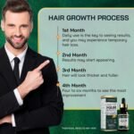 Jardient Minoxidil 5% Serum for Men and Women: Hair Growth Oil with Monoxide, Biotin, Beard Growth Kit - Minoxidil Serum - 1 Fl Oz - Prevent Hair Loss, Regrowth Treatment - Image 7
