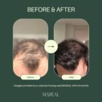 Pure Rosemary Oil for Hair Growth & Scalp Health | Infused with Castor & Coconut Oil | Hair Thickening & Regrowth Treatment for Women & Men | 100% Natural | Up to 3-Month Supply | 1.7 fl oz - Image 2