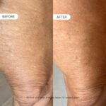 OneSkin BODY OS-01 Peptide Topical Supplement & Skin Longevity Age Reversal Moisturizer | Safe for Sensitive Skin, Fragrance-Free, 250 mL / 8.45 oz - Image 4