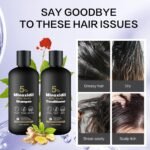 Minoxidil Shampoo & Conditioner Set for Hair Growth – Biotin, Ginseng & Ginger – Supports Thicker, Fuller Hair – Scalp Care Formula – For Men & Women – 600ml Duo - Image 7