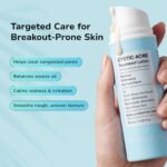 BellamiLuxx Cystic Acne Treatment for Face: Hormonal Acne Treatment Cream for Teens & Adults - Salicylic Acid & Tea Tree Oil Pimple Spot Remover - Anti-Acne Moisturizer Reduces Redness, Blemishes - Image 4