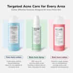 BellamiLuxx Cystic Acne Treatment for Face: Hormonal Acne Treatment Cream for Teens & Adults - Salicylic Acid & Tea Tree Oil Pimple Spot Remover - Anti-Acne Moisturizer Reduces Redness, Blemishes - Image 7