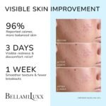 BellamiLuxx Cystic Acne Treatment for Face: Hormonal Acne Treatment Cream for Teens & Adults - Salicylic Acid & Tea Tree Oil Pimple Spot Remover - Anti-Acne Moisturizer Reduces Redness, Blemishes - Image 2