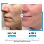 Retinol Face Serum, Reduces Wrinkles, Age Spots, Post-Acne Marks. Stimulates Collagen, Firm Skin, Anti Aging with Hyaluronic Acid, Niacinamide (30ml) Soti - Image 3