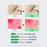 VT COSMETICS CICA Reedle Shot 100 Microneedling Serum | Spicule, Pore Care & Exfoliation, Exosome, Centella Asiatica for Glass Skin, Skin Texture - Image 6