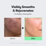 VT COSMETICS CICA Reedle Shot 100 Microneedling Serum | Spicule, Pore Care & Exfoliation, Exosome, Centella Asiatica for Glass Skin, Skin Texture - Image 5