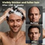 Root Activator Shampoo For Men - Hair Growth Shampoo for Hair Loss and Thinning Hair - 300 mL/10.1 fl oz - Image 4