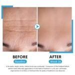 Retinol Face Serum, Reduces Wrinkles, Age Spots, Post-Acne Marks. Stimulates Collagen, Firm Skin, Anti Aging with Hyaluronic Acid, Niacinamide (30ml) Soti - Image 5