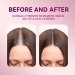 5% Minoxidil Hair Growth Women, Minoxidil for Women Hair Growth Serum with Biotin & Castor Oil, Helps Reduce Hair Loss & Thinning, Strengthens Roots, 60ml x 2 Bottles - Image 4