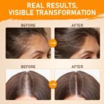 Batana Oil for Hair Growth–100% Pure Unrefined with Rosemary, Castor & Pumpkin Seed Oils, Infused with Biotin | Strengthens, Repairs Scalp, Nourishes & Reduces Hair Loss for Men & Women– 4 oz x 2 Pack - Image 4