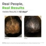 AVIMEE HERBAL Keshpallav Hair Oil for Hair Growth | For Both Men & Women | Helps to reduce Hair Fall | With Rosemary, Castor, Amla, Coconut and Bhringraj Oil | Mineral Oil Free (Pack of 2) - Image 3