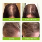 Hair Growth Serum Spray - with Rosemary Batana Oil Biotin for Hair Loss and Thinning Hair - Thicker Fuller Hair for Women Men 2 Fl Oz (Pack of 1) - Image 4