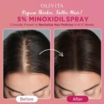5% Minoxidil Spray for Women Hair Growth: Extra Strength Hair Regrowth Treatment – Revitalize Hair Follicles & Regrow Thicker, Fuller Hair – Hair Loss Solution - 2 Packs - Image 4