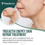 TreeActiv Crepey Skin Repair Cream, 8 oz Firming Body & Neck Cream with Hyaluronic Acid, Glycolic Acid & Shea Butter, Helps Crepey Skin Look Smoother, 500+ Uses - Image 2