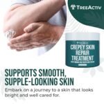 TreeActiv Crepey Skin Repair Cream, 8 oz Firming Body & Neck Cream with Hyaluronic Acid, Glycolic Acid & Shea Butter, Helps Crepey Skin Look Smoother, 500+ Uses - Image 7