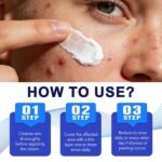 Folliculitis Care & Cystic Acne Cream for Face and Body – 1% Salicylic Acid - Image 9