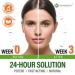 Salicylic Acid Face Cream - Clarifying Moisturizer for Acne-Prone Skin - Image 3