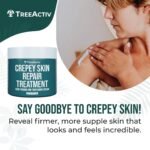 TreeActiv Crepey Skin Repair Cream, 8 oz Firming Body & Neck Cream with Hyaluronic Acid, Glycolic Acid & Shea Butter, Helps Crepey Skin Look Smoother, 500+ Uses - Image 3