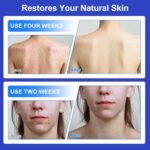 Folliculitis Care & Cystic Acne Cream for Face and Body – 1% Salicylic Acid - Image 5