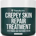 TreeActiv Crepey Skin Repair Cream, 8 oz Firming Body & Neck Cream with Hyaluronic Acid, Glycolic Acid & Shea Butter, Helps Crepey Skin Look Smoother, 500+ Uses