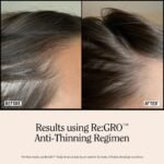 California Naturals Women's ReGRO Anti-Thinning Scalp Serum, 5% Capixyl with Biotin, Caffeine & Castor and Rosemary Oil, Non-Sticky Cooling Formula, Vegan & Cruelty Free, 3oz - Image 9