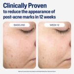Cetaphil Gentle Clear Post-Acne Skin Serum, Bakuchiol Retinol Alt, 1oz - Image 5