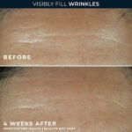 RoC Retinol Correxion Wrinkle Filler for Deep Wrinkles with Hyaluronic Acid - Image 4