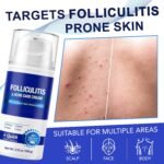 Folliculitis Care & Cystic Acne Cream for Face and Body – 1% Salicylic Acid - Image 2