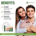 Salicylic Acid Face Cream - Clarifying Moisturizer for Acne-Prone Skin - Image 5