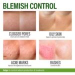 Salicylic Acid Face Cream - Clarifying Moisturizer for Acne-Prone Skin - Image 4